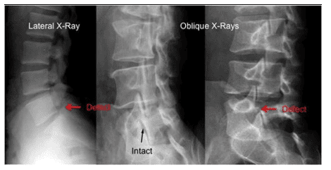 
Chụp X quang cơ xương khớp là phương pháp an toàn và không gây ảnh hưởng đến sức khỏe người bệnh
