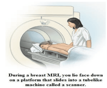 
Tư thế nằm khi chụp MRI vú
