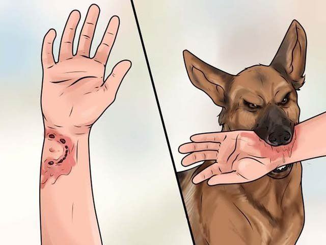 First aid for wounds caused by animal bites Vinmec