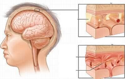 
Viêm màng nào, áp xe não, viêm não là các bệnh về não do nhiễm trùng.
