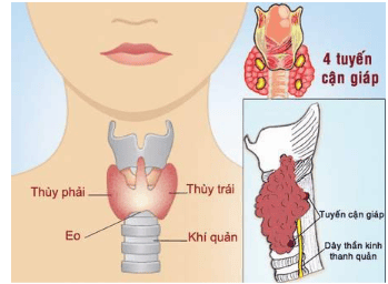 
Thùy trái tuyến giáp và thùy phải tuyến giáp
