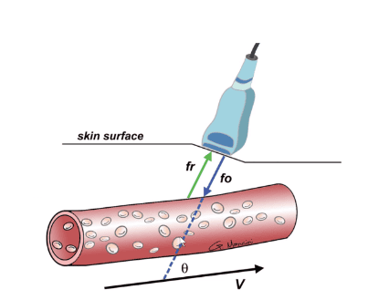 
Siêu âm Doppler mạch máu
