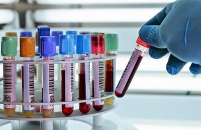 Clinical significance of blood phosphate test results