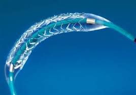 
Hình ảnh stent phủ thuốc
