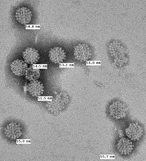 
Hình ảnh phóng đại Merkel cell polyomavirus (MCV)
