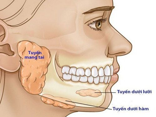 Các nhiễm trùng khoang dưới hàm