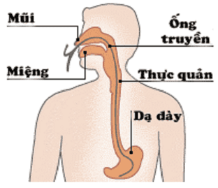 
Phương pháp nuôi ăn qua ống sonde
