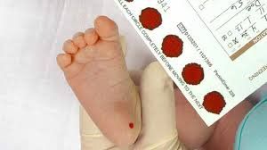 Bé lấy máu gót chân HbA là 11,9 (15-40%); HbF là 88,1 (60-85%) có sao không?