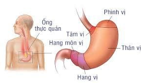 
Vị trí dạ dày của người béo và người gầy có sự khác biệt
