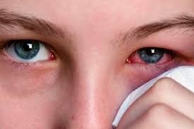 Xuất huyết mắt có nguy hiểm?