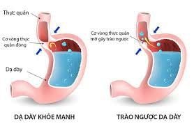 Stool like diarrhea when treating gastroesophageal reflux disease with gastritis, what to do?