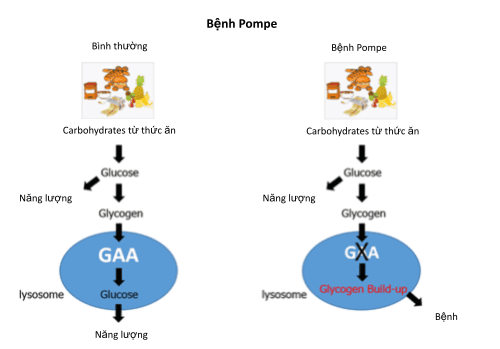 
Nguồn ảnh: Newbornscreening.info
