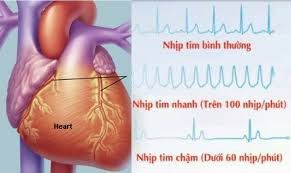 How is tachycardia treated?