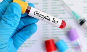 
Phương pháp xét nghiệm Chlamydia IgG để chẩn đoán bệnh Chlamydia có độ nhạy 95.3% và độ đặc hiệu 98.2%
