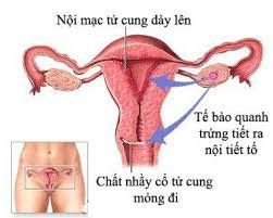 Siêu âm không có thai nhưng nội mạc tử cung 14mm liệu có thai hay không?