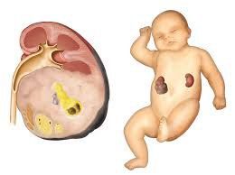 Trẻ 7 tháng tuổi bị u nguyên bào thận trái có nguy hiểm không?