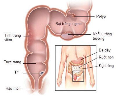 
Cấu tạo của đại tràng.
