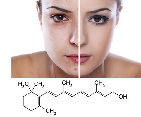 
Hiệu quả khi sử dụng Retinol
