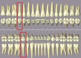 Răng số 5 bị sứt và thỉnh thoảng đau buốt phía trong phải làm gì?