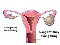 6 weeks pregnant with single lobe ovarian cyst is it dangerous?