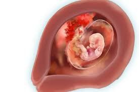 At 7 weeks pregnant, how does the length of the gestational sac not corresponding to the embryo improve?