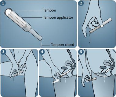 
Hướng dẫn sử dụng băng vệ sinh tampon.
