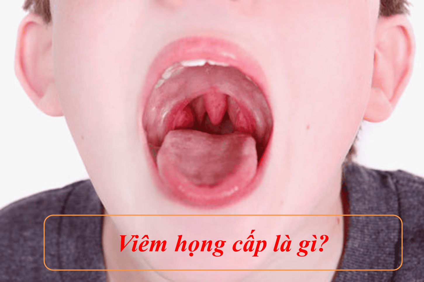 Hay bị viêm họng tái đi tái lại: Nguyên nhân, triệu chứng và cách điều trị hiệu quả