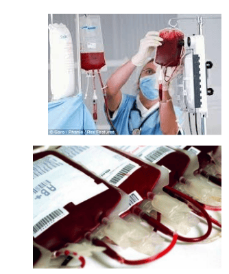 Complications of massive blood transfusion