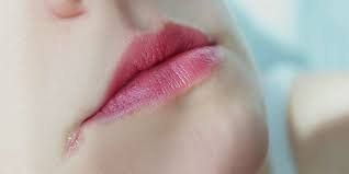 Angular cheilitis: Symptoms, causes and treatment