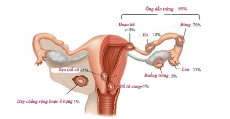 Thai nhi 4 tuần cách vết mổ cũ 12mm có sao không?