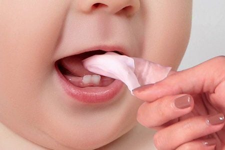 Bé 2 tuổi bị nấm lưỡi tái đi tái lại có phải ung thư lưỡi không?