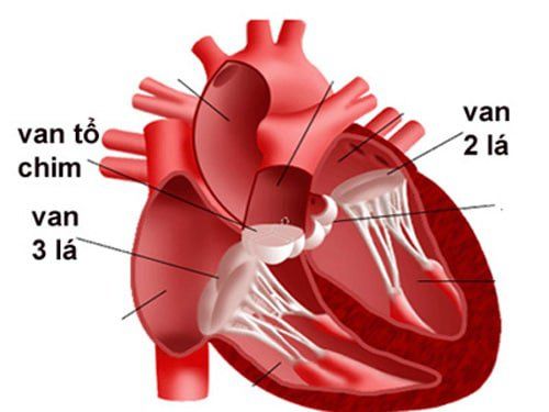 
Teo van 3 lá là một dị tật tim bẩm sinh nghiêm trọng
