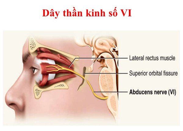 Phương pháp điều trị