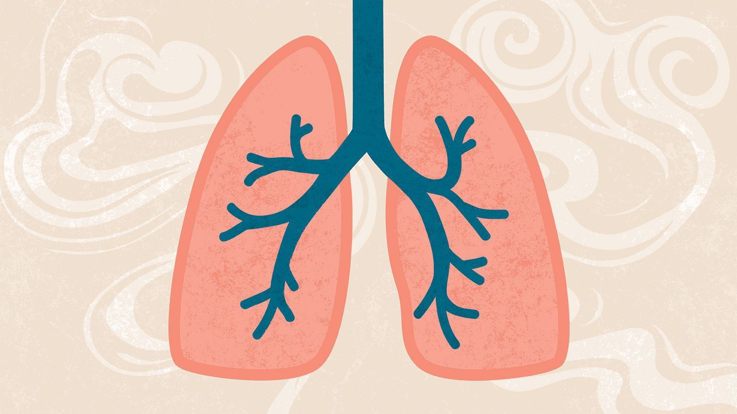 Nutrition for patients with COPD (chronic obstructive pulmonary disease)