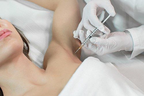 
Chữa tăng tiết mồ hôi tại vùng dưới cánh tay sử dụng botox
