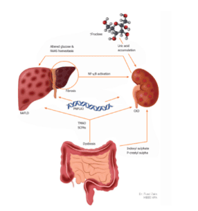 Hepatic risk factors associated with chronic kidney disease in nonalcoholic fatty liver disease