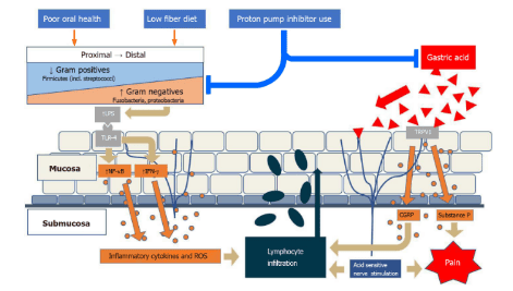 Microbial imbalance in benign upper gastrointestinal diseases