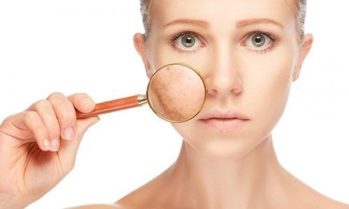 Is the treatment of melasma with traditional Chinese medicine effective?