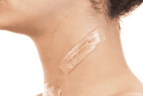 Does Corticosteroid Injection for Keloid Scars Have Any Adverse Effects?