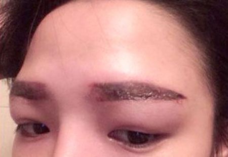 Broken eyebrow tattoo: Signs and how to fix it