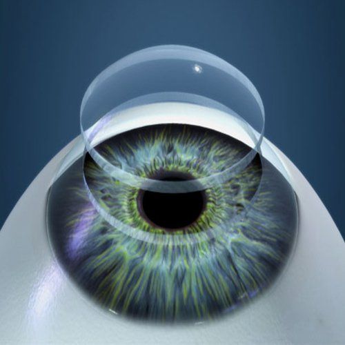 Indications for corneal transplantation