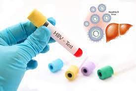 What should be done with the test results for the diagnosis of hepatitis B infection?