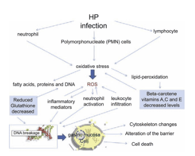 
Trình tự sinh bệnh học của nhiễm vi khuẩn Hp làm tăng sản xuất gốc tự do và các cytokine gây viêm, cho thấy việc tuyển dụng các tế bào bạch cầu khi giảm khả năng phòng thủ chống oxy hóa dẫn đến sự thay đổi của các tế bào niêm mạc dạ dày và do đó của hàng rào niêm mạc dạ dày.
