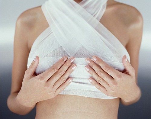 Sự khác nhau giữa nâng ngực chảy xệ có và không đặt túi