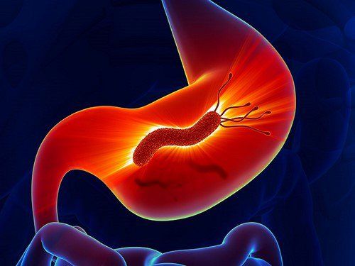 Is H.pylori infection certain to get stomach cancer?