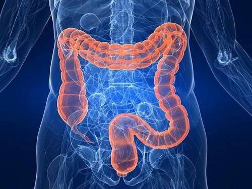 New-onset inflammatory bowel disease in patients after kidney transplantation