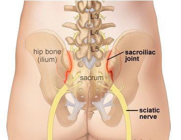 Pelvic joint pain: What you need to know