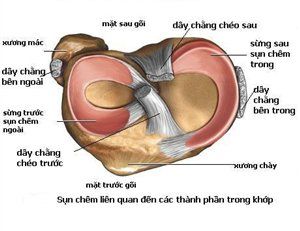 
Hình ảnh giải phẫu sụn chêm
