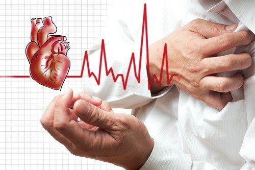 Value of cardiac enzyme H-FABP in the diagnosis of myocardial infarction