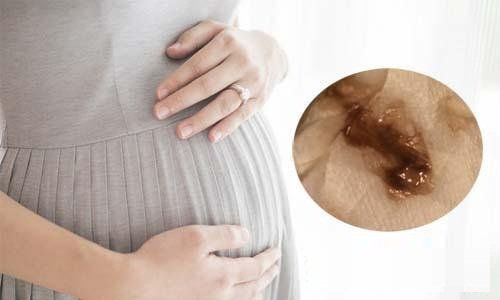 What does brownish discharge at 38 weeks of pregnancy indicate any conditions?